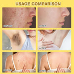 Bee Venom Skin Treatment Cream