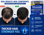 Kirkland Minoxidil 5% Extra Strength Hair Regrowth Treatment for Men 6 Bottles (6 Month Supply)